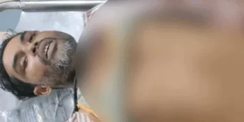 নিহত ডালিম আহমদ।